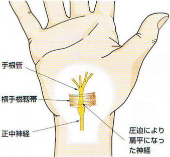 �荪�Ǐǌ�Q,�@�荪��,�@���荪�x��,�@�����_�o,�@�����ɂ��G���ɂȂ����_�o,�@��O��,�@���,�@��ʎ�O�Ȍ�����,�@�����R�s,�@�F�J�s,�@���c�a�@,�@���˃��J���т��a�@,�@��t���F��a�@,�@�����Ȃ�