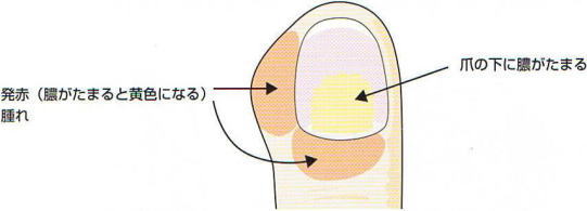 �܎��͉�,�@���ԁi�^�����܂�Ɖ��F�ɂȂ�j,�@���,�@�܂̉��ɔ^�����܂�,�@��O��,�@���,�@��ʎ�O�Ȍ�����,�@�����R�s,�@�F�J�s,�@���c�a�@,�@���˃��J���т��a�@,�@��t���F��a�@,�@�����Ȃ�