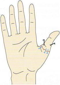 �ؒf�w�Đڒ�,�@��O��,�@���,�@��ʎ�O�Ȍ�����,�@�����R�s,�@�F�J�s,�@���c�a�@,�@���˃��J���т��a�@,�@��t���F��a�@,�@�����Ȃ�