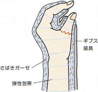 �ؒf�w�Đڒ�,�@���΂��K�[�[,�@�e�����,�@�M�v�X����,�@��O��,�@���,�@��ʎ�O�Ȍ�����,�@�����R�s,�@�F�J�s,�@���c�a�@,�@���˃��J���т��a�@,�@��t���F��a�@,�@�����Ȃ�