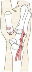 ��wCM�֐ߏ�,�@��O��,�@���,�@��ʎ�O�Ȍ�����,�@�����R�s,�@�F�J�s,�@���c�a�@,�@���˃��J���т��a�@,�@��t���F��a�@,�@�����Ȃ�