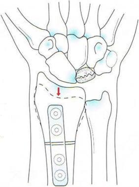 �L�[���x�b�N�a�i���󍜓�ǁj,�@��O��,�@���,�@��ʎ�O�Ȍ�����,�@�����R�s,�@�F�J�s,�@���c�a�@,�@���˃��J���т��a�@,�@��t���F��a�@,�@�����Ȃ�