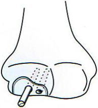 �싅�I,�@��O��,�@���,�@��ʎ�O�Ȍ�����,�@�����R�s,�@�F�J�s,�@���c�a�@,�@���˃��J���т��a�@,�@��t���F��a�@,�@�����Ȃ�