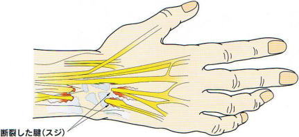 �f�􂵂��F�i�X�W�j,�@���E�}�`�ɂ���̏�Q,�@�L���F�f��,�@��O��,�@���,�@��ʎ�O�Ȍ�����,�@�����R�s,�@�F�J�s,�@���c�a�@,�@���˃��J���т��a�@,�@��t���F��a�@,�@�����Ȃ�