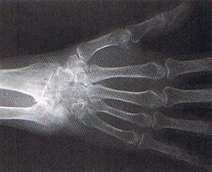 ���E�}�`�ɂ���̏�Q,�@�L���F�f��,�@��O��,�@���,�@��ʎ�O�Ȍ�����,�@�����R�s,�@�F�J�s,�@���c�a�@,�@���˃��J���т��a�@,�@��t���F��a�@,�@�����Ȃ�