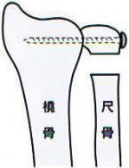 ��,�@�ڍ�,�@���E�}�`�ɂ���̏�Q,�@�L���F�f��,�@��O��,�@���,�@��ʎ�O�Ȍ�����,�@�����R�s,�@�F�J�s,�@���c�a�@,�@���˃��J���т��a�@,�@��t���F��a�@,�@�����Ȃ�