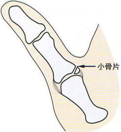 ��wMP�֐ߐx�ё���,�@������,�@��O��,�@���,�@��ʎ�O�Ȍ�����,�@�����R�s,�@�F�J�s,�@���c�a�@,�@���˃��J���т��a�@,�@��t���F��a�@,�@�����Ȃ�