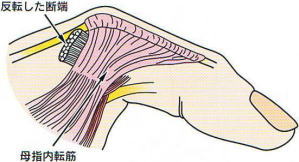 ��w���]��,�@���]�����f�[,�@��wMP�֐ߐx�ё���,�@��O��,�@���,�@��ʎ�O�Ȍ�����,�@�����R�s,�@�F�J�s,�@���c�a�@,�@���˃��J���т��a�@,�@��t���F��a�@,�@�����Ȃ�