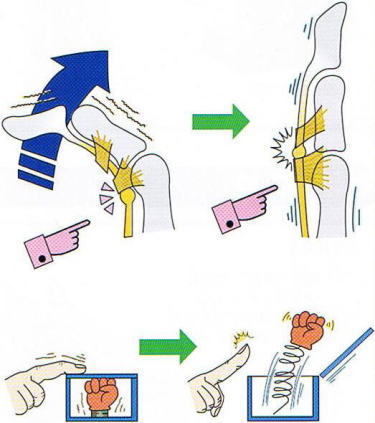 �΂ˎw,�@�e���w,�@��O��,�@���,�@��ʎ�O�Ȍ�����,�@�����R�s,�@�F�J�s,�@���c�a�@,�@���˃��J���т��a�@,�@��t���F��a�@,�@�����Ȃ�