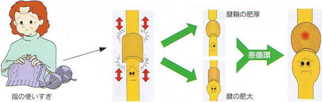 �΂ˎw,�@�e���w,�@�w�̎g������,�@�F��̔��,�@�F�̔��,�@���z��,�@��O��,�@���,�@��ʎ�O�Ȍ�����,�@�����R�s,�@�F�J�s,�@���c�a�@,�@���˃��J���т��a�@,�@��t���F��a�@,�@�����Ȃ�