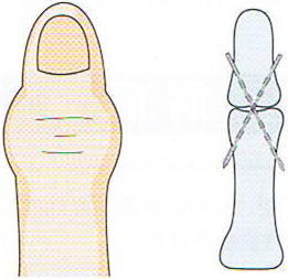 �w�o�[�f������,�@��O��,�@���,�@��ʎ�O�Ȍ�����,�@�����R�s,�@�F�J�s,�@���c�a�@,�@���˃��J���т��a�@,�@��t���F��a�@,�@�����Ȃ�