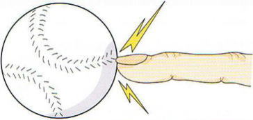 �}���b�g�ό`,�@�Ǝw,�@��O��,�@���,�@��ʎ�O�Ȍ�����,�@�����R�s,�@�F�J�s,�@���c�a�@,�@���˃��J���т��a�@,�@��t���F��a�@,�@�����Ȃ�