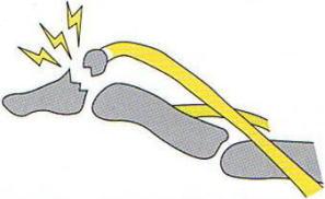 �}���b�g�ό`,�@�Ǝw,�@��O��,�@���,�@��ʎ�O�Ȍ�����,�@�����R�s,�@�F�J�s,�@���c�a�@,�@���˃��J���т��a�@,�@��t���F��a�@,�@�����Ȃ�