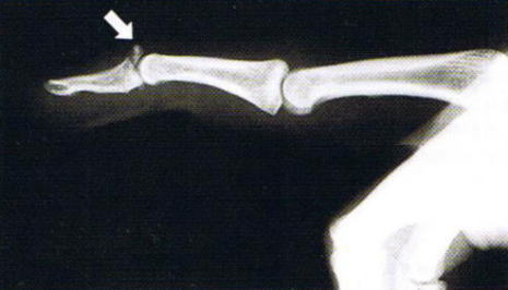 �}���b�g�ό`,�@�Ǝw,�@��O��,�@���,�@��ʎ�O�Ȍ�����,�@�����R�s,�@�F�J�s,�@���c�a�@,�@���˃��J���т��a�@,�@��t���F��a�@,�@�����Ȃ�