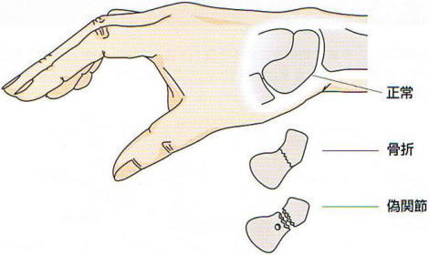 �M�󍜍���,�@����,�@����,�@�U�֐�,�@��O��,�@���,�@��ʎ�O�Ȍ�����,�@�����R�s,�@�F�J�s,�@���c�a�@,�@���˃��J���т��a�@,�@��t���F��a�@,�@�����Ȃ�